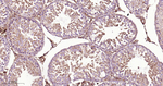 B-Raf Antibody in Immunohistochemistry (Paraffin) (IHC (P))