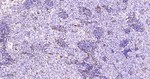 MMP1 Antibody in Immunohistochemistry (Paraffin) (IHC (P))