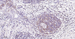 MMP1 Antibody in Immunohistochemistry (Paraffin) (IHC (P))