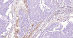 MMP1 Antibody in Immunohistochemistry (Paraffin) (IHC (P))