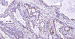 MMP1 Antibody in Immunohistochemistry (Paraffin) (IHC (P))