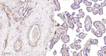 MMP1 Antibody in Immunohistochemistry (Paraffin) (IHC (P))