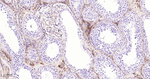 MMP1 Antibody in Immunohistochemistry (Paraffin) (IHC (P))