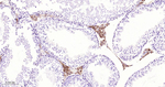 MMP1 Antibody in Immunohistochemistry (Paraffin) (IHC (P))