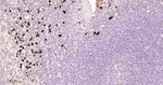 Human IgG4 Antibody in Immunohistochemistry (Paraffin) (IHC (P))
