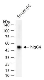 Human IgG4 Antibody in Western Blot (WB)