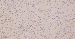 FAK Antibody in Immunohistochemistry (Paraffin) (IHC (P))