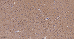 FAK Antibody in Immunohistochemistry (Paraffin) (IHC (P))