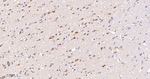 FAK Antibody in Immunohistochemistry (Paraffin) (IHC (P))