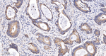 FAK Antibody in Immunohistochemistry (Paraffin) (IHC (P))