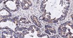 FAK Antibody in Immunohistochemistry (Paraffin) (IHC (P))