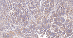 FAK Recombinant Rabbit Monoclonal Antibody (6F1)