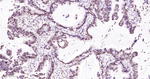 Histone H2A Recombinant Rabbit Monoclonal Antibody (2F12)