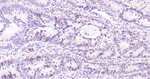 Rb Recombinant Rabbit Monoclonal Antibody (9F5)