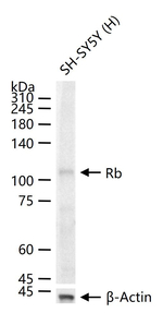 Rb Antibody in Western Blot (WB)