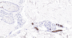 Cytokeratin 6 Antibody in Immunohistochemistry (Paraffin) (IHC (P))