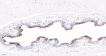 Cytokeratin 6 Antibody in Immunohistochemistry (Paraffin) (IHC (P))