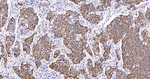 Cytokeratin 6 Antibody in Immunohistochemistry (Paraffin) (IHC (P))