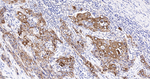 Cytokeratin 6 Antibody in Immunohistochemistry (Paraffin) (IHC (P))