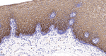 Cytokeratin 6 Antibody in Immunohistochemistry (Paraffin) (IHC (P))