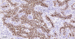 Cytokeratin 6 Recombinant Rabbit Monoclonal Antibody (5F9)