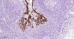 Cytokeratin 6 Antibody in Immunohistochemistry (Paraffin) (IHC (P))