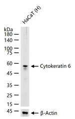 Cytokeratin 6 Antibody in Western Blot (WB)