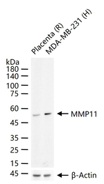 MMP11 Recombinant Rabbit Monoclonal Antibody (12F7)