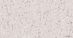 Phospho-PKC zeta (Thr560) Antibody in Immunohistochemistry (Paraffin) (IHC (P))