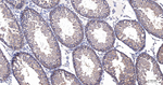 Phospho-PKC zeta (Thr560) Antibody in Immunohistochemistry (Paraffin) (IHC (P))