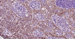 CDK4 Antibody in Immunohistochemistry (Paraffin) (IHC (P))