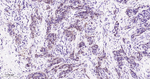 CDK4 Antibody in Immunohistochemistry (Paraffin) (IHC (P))