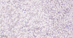 CDK4 Antibody in Immunohistochemistry (Paraffin) (IHC (P))