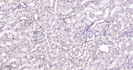 CDK4 Antibody in Immunohistochemistry (Paraffin) (IHC (P))