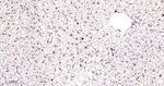 CDK4 Antibody in Immunohistochemistry (Paraffin) (IHC (P))