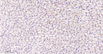 CDK4 Antibody in Immunohistochemistry (Paraffin) (IHC (P))