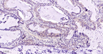 CDK4 Antibody in Immunohistochemistry (Paraffin) (IHC (P))