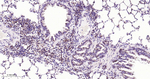 CDK4 Antibody in Immunohistochemistry (Paraffin) (IHC (P))