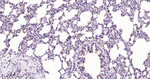CDK4 Antibody in Immunohistochemistry (Paraffin) (IHC (P))