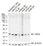 CDK4 Antibody in Western Blot (WB)