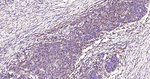 STAT1 Antibody in Immunohistochemistry (Paraffin) (IHC (P))