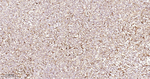 STAT1 Antibody in Immunohistochemistry (Paraffin) (IHC (P))