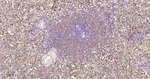 STAT1 Antibody in Immunohistochemistry (Paraffin) (IHC (P))