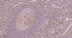 STAT1 Antibody in Immunohistochemistry (Paraffin) (IHC (P))