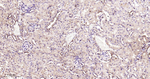 STAT1 Antibody in Immunohistochemistry (Paraffin) (IHC (P))
