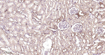 STAT1 Antibody in Immunohistochemistry (Paraffin) (IHC (P))