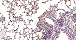 STAT1 Antibody in Immunohistochemistry (Paraffin) (IHC (P))