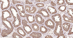 14-3-3 Pan Antibody in Immunohistochemistry (Paraffin) (IHC (P))