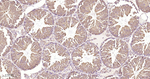14-3-3 Pan Antibody in Immunohistochemistry (Paraffin) (IHC (P))