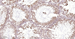 14-3-3 Pan Antibody in Immunohistochemistry (Paraffin) (IHC (P))